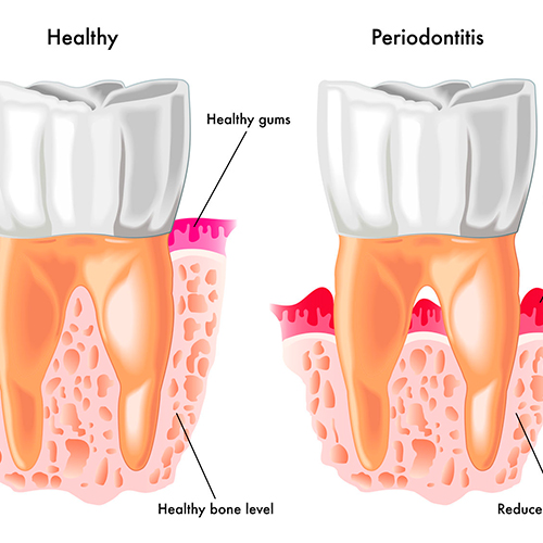 periodoncia