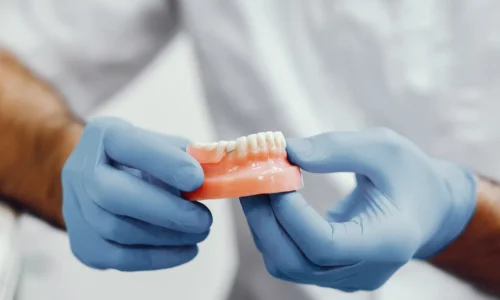 Prótesis dentales tipo removibles en clínica cenn.