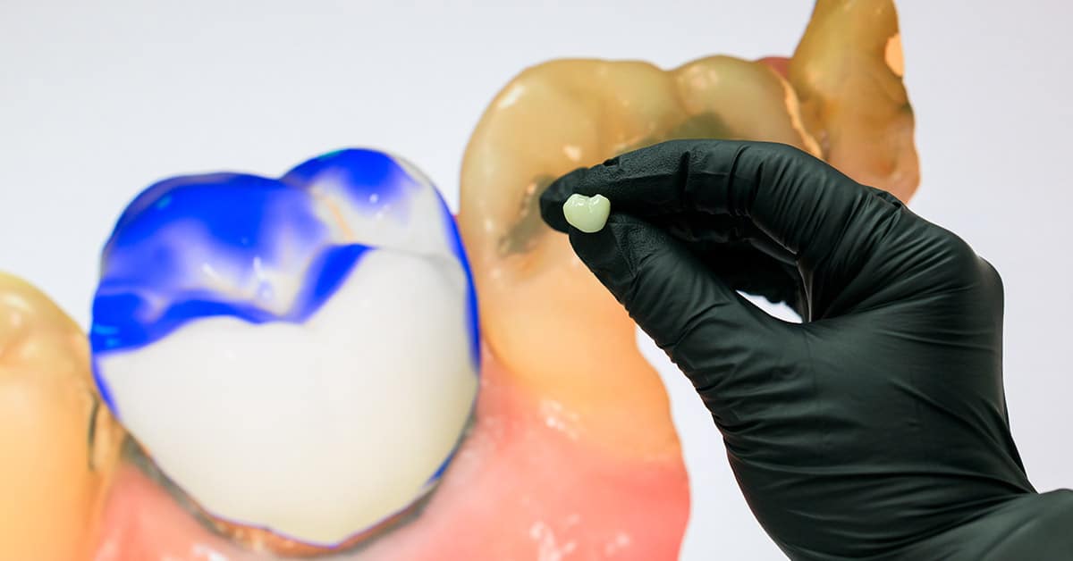 tecnologia-cerec-cenn-2