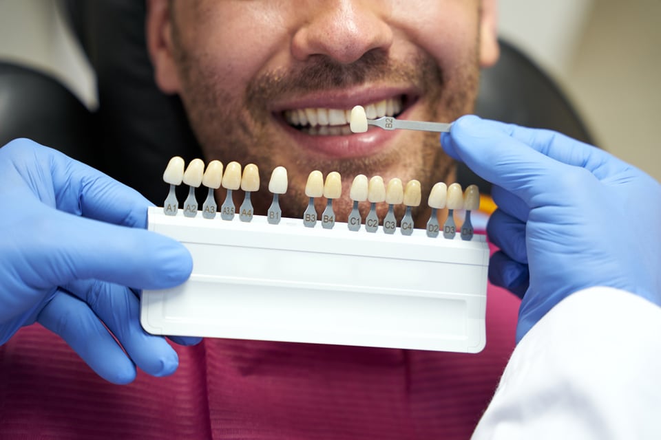 corona-dental-cenn