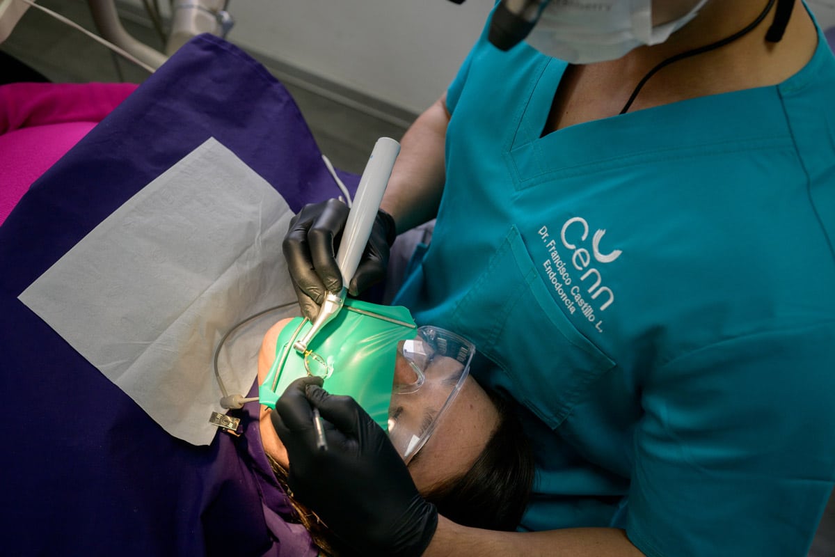 endodoncia-tratamiento-dental-cenn