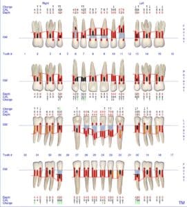 periodontogramas sonda florida