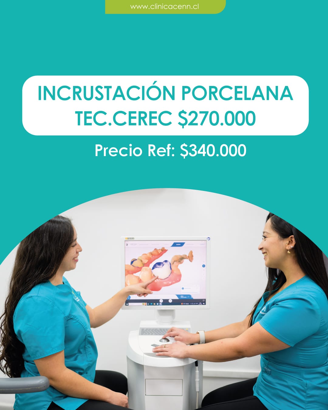 incrustación porcelana tecnologia cerec clinica cenn