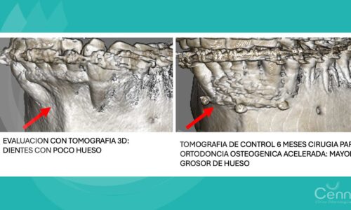 tomografías cone beam en clínica Cenn