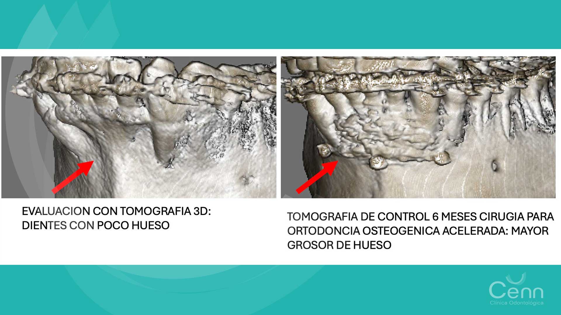 tomografías cone beam en clínica Cenn