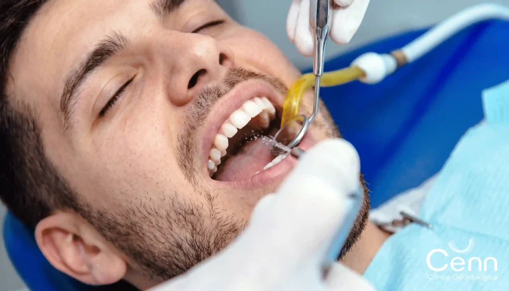 aprende qué es la limpieza dental profunda en clínica Cenn